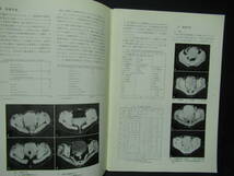 富士X-レイ研究　NO.１２２　１９７９　レントゲン　X線　技術　解説　放射線科　A-11_画像3