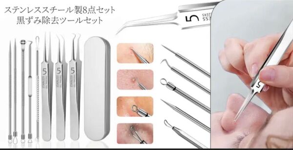 ピンセット コメドプッシャー 毛穴ケア ニキビケア角栓除去に よく取れる ニキビケア にゅるにゅるよく取れる 角栓取りに