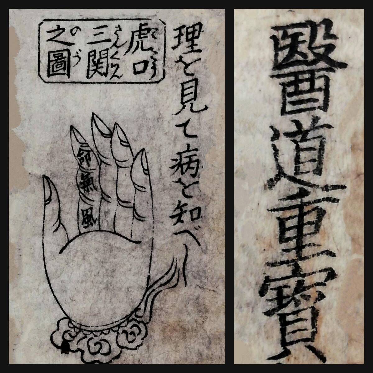 Amazon.co.jp: 宋本傷寒論: 現代語訳 : 劉渡舟, 姜元安, 生島忍: 本