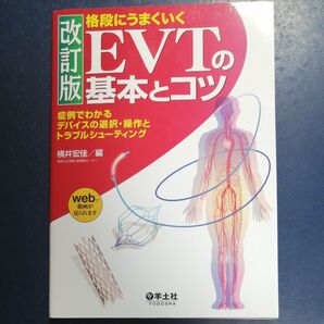 格段にうまくいくEVTの基本とコツ改訂版