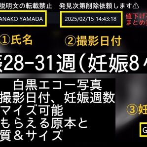 妊娠8ヶ月 妊娠後期 日付&名入れ可能 原本同様感熱紙 エコー写真 値下不可