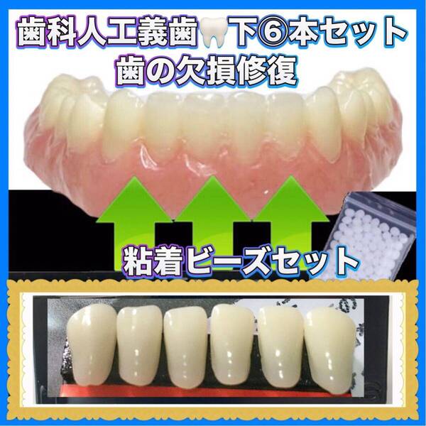 歯科人工歯 前歯下段6本 歯の欠損修復 高品質樹脂製 高級義歯全6個セット 義歯 仮歯 付け歯 入れ歯 インスタントスマイル 互換品6