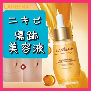 ニキビ 傷跡 修復美容液 傷跡クリーム 新品未使用品 美容液 コスメ