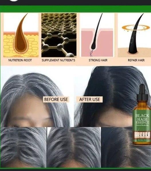 Black Hair Essence 9本セット 白髪 白ひげ 改善 美容液
