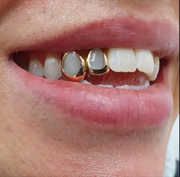 グリルズ GRILLZ グリッター ゴールド 説明書付き