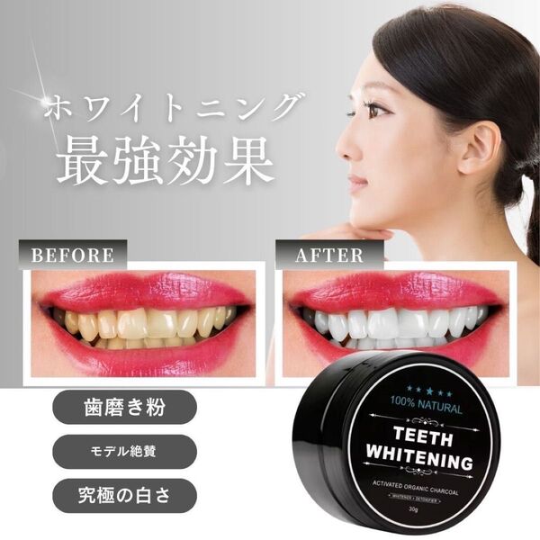 効果No.1 最強 ホワイトニング 歯磨き粉 メイクさん愛用 オーラルケア