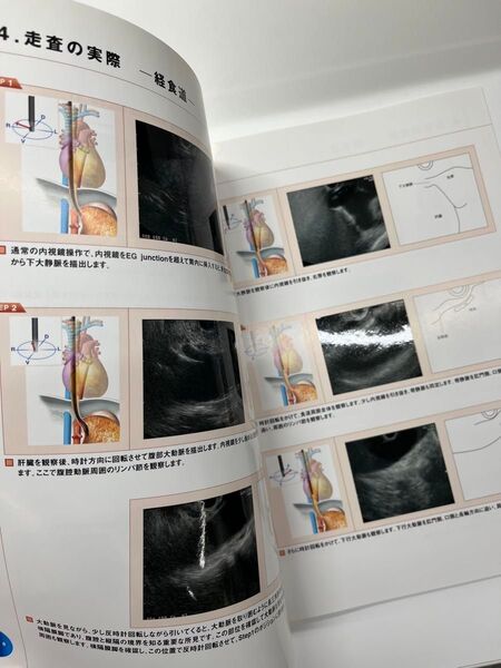 超音波内視鏡下穿刺術のためのコンベックス型超音波内視鏡による標準的描出法