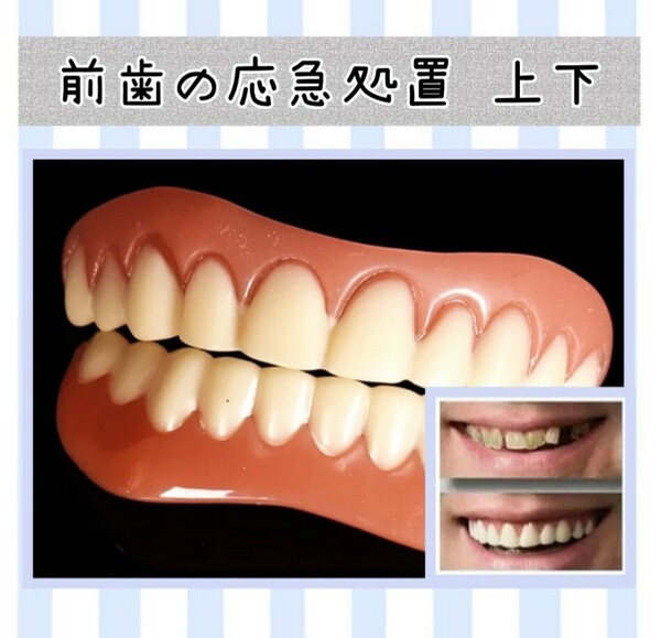 【新品未使用】歯の応急処置 前歯のカバー 仮歯