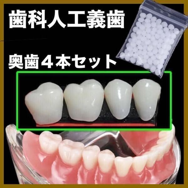 【特別値下げ】 高品質義歯 歯科人工義歯 下段奥歯 奥歯全4個 義歯 仮歯 付け歯 入れ歯 インスタントスマイル 粘着素材セット TX