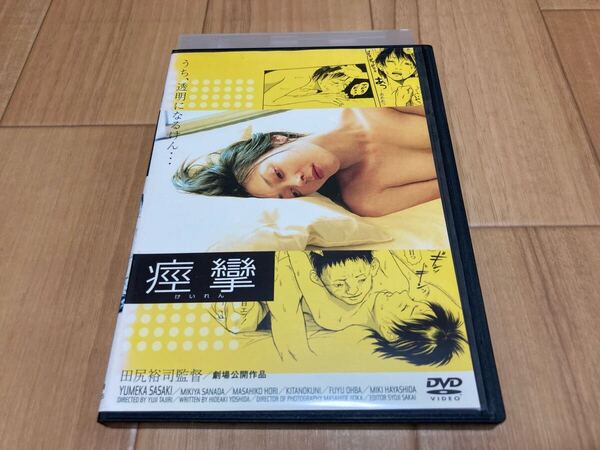 DVD 痙攣