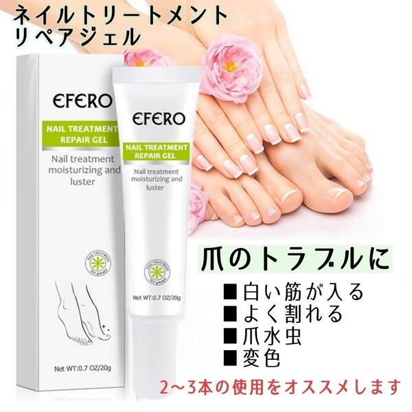 【売れてます!!】爪のトラブル ネイルトリートメント ネイルクリーム ネイルケア 爪水虫 爪真菌 白癬菌 爪の変色 乾燥 割れ ツヤ