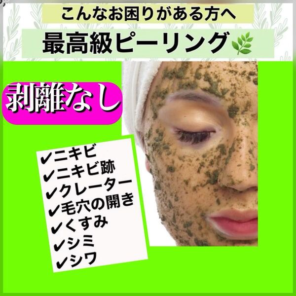 ハーブピーリング 剥離なし