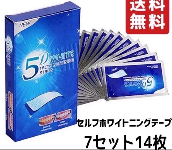 セルフホワイト ホームホワイト ホワイトニング 白い歯 綺麗な歯 ツルツル ホワイトニングシート 白歯 美歯口 オーラルケア