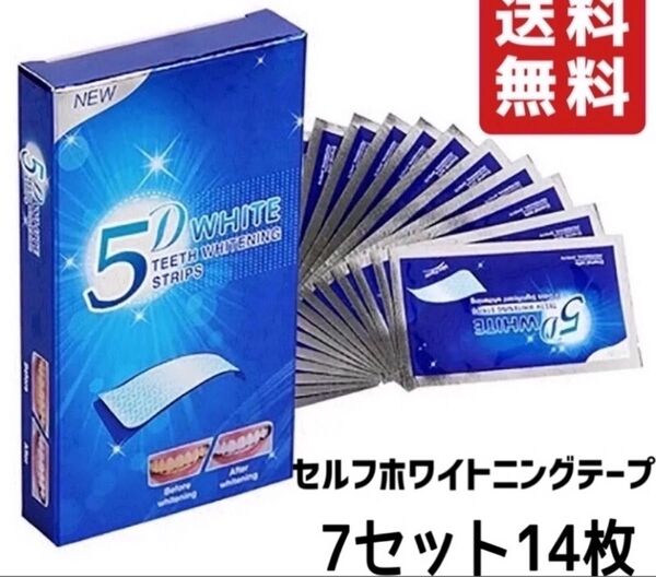 セルフホワイト ホームホワイト ホワイトニング 白い歯 綺麗な歯 ツルツル ホワイトニングシート 白歯 美歯口 オーラルケア