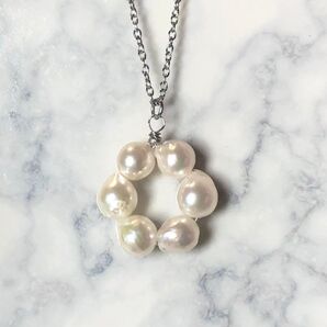 金属アレルギー対応 天然 あこや真珠 パール ネックレス サージカルステンレス シェル アコヤ貝 真珠