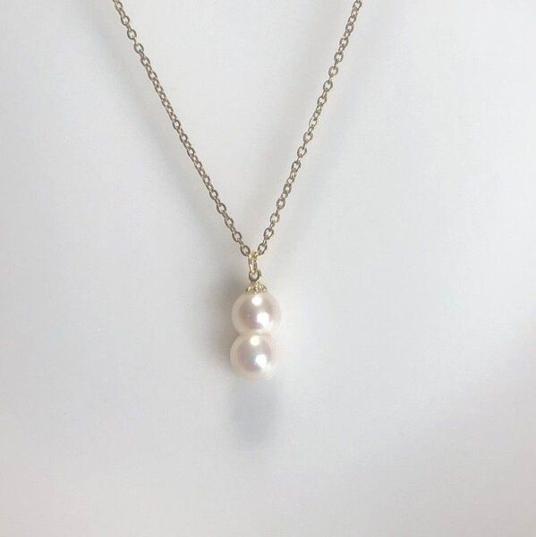 金属アレルギー対応 天然あこや 双子風 7mm×2粒 天然アコヤ パール ネックレス サージカルステンレス シェル アコヤ貝