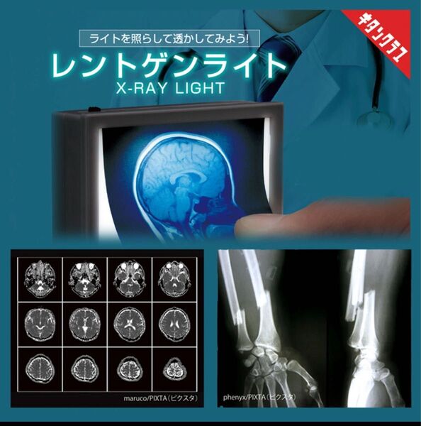 レントゲンライト