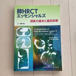 肺HRCTエッセンシャルズ 読影の基本と鑑別診断 ブレット M.エリッカー/著 W.リチャード ウェッブ/著 高橋雅士/訳