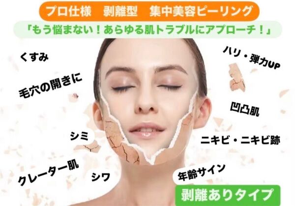★つるんと剥きたてたまご肌へ★剥離あり!高濃度美容のスペシャルケア 肌を土台から整える!マイクロハーブピーリング3回分