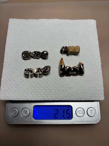 除去冠 21.5g