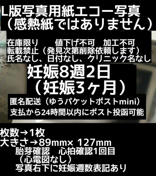 【値下げ不可】L版写真用紙 妊娠8週2 日 エコー写真 妊娠初期 妊娠3ヶ月