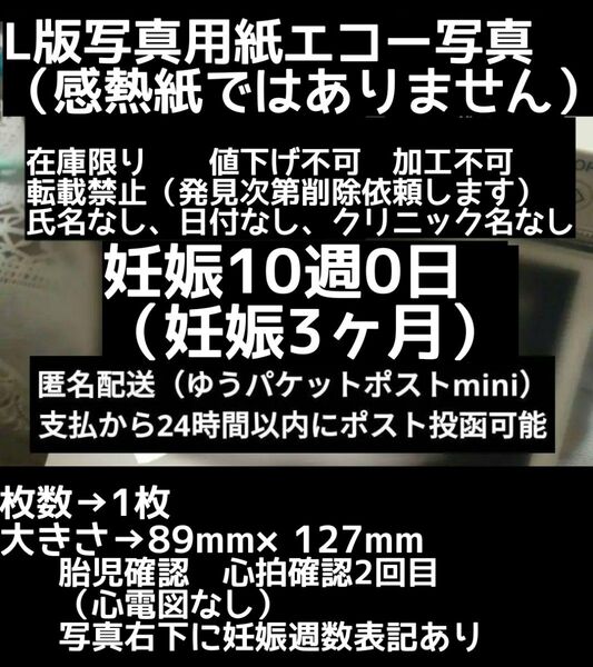 【値下げ不可】L版写真用紙 妊娠10週0日 エコー写真 妊娠初期 妊娠3ヶ月