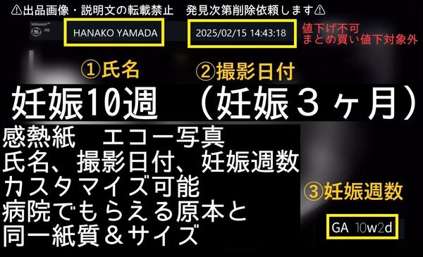 【感熱紙】妊娠10週 日付&名入れ可能 エコー写真 妊娠3ヶ月 値下げ不可