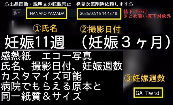 【感熱紙】妊娠11週 日付&名入れ可能 エコー写真 妊娠3ヶ月 値下げ不可
