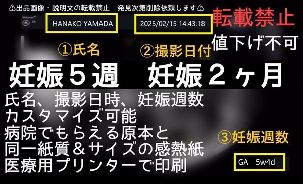 【感熱紙】妊娠5週 日付&名入れ可能 原本同様 エコー写真 妊娠2ヶ月 胎嚢確認 値下不可
