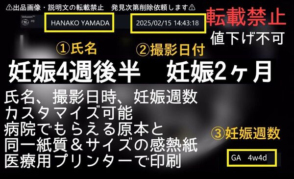 妊娠4週後半 日付&名入れ可能 原本同様感熱紙 エコー写真 妊娠2ヶ月 値下不可 妊娠初期