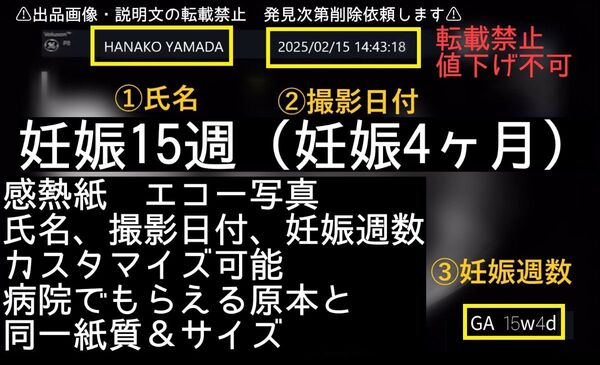 妊娠15週 妊娠4ヶ月 日付&名入れ可能 原本同様感熱紙 エコー写真 値下不可 まとめ買い値下対象外