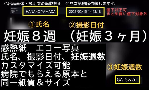 【値下げ不可】妊娠8週 撮影日時&妊娠日数&氏名のカスタマイズ可能 原本同様感熱紙 エコー写真 妊娠3ヶ月 妊娠初期