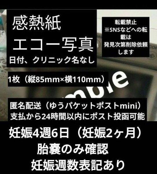 値下げ不可【感熱紙】妊娠4週6日 妊娠初期 エコー写真 妊娠2ヶ月