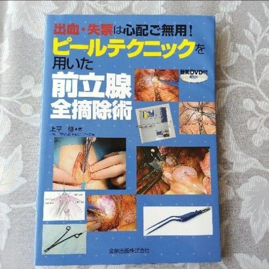 出血・失禁は心配ご無用!ピールテクニックを用いた前立腺全摘除術