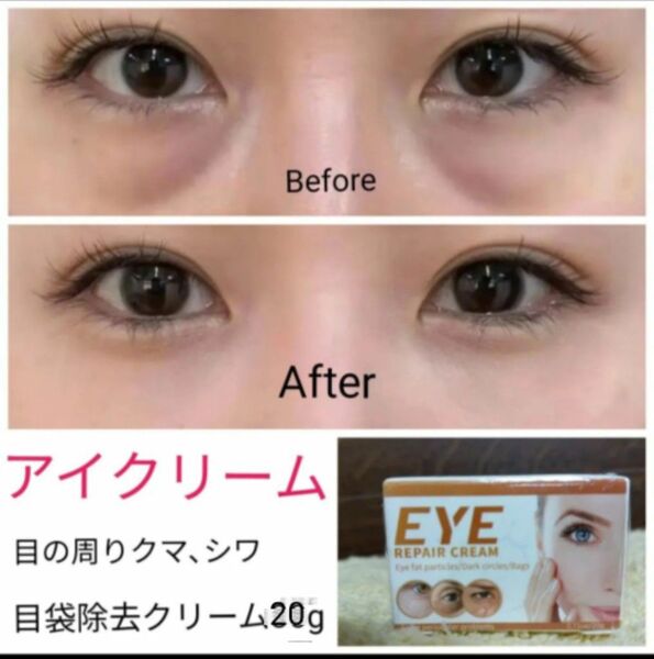 カテ変更◎アイクリーム20g目の周りのクマ、 シワ、目袋除去 美容クリーム ほうれい線 保湿美肌 肌のケア 目と肌を明るく