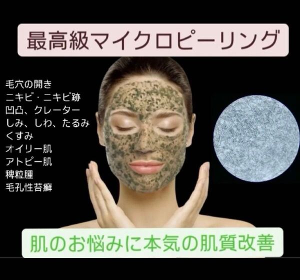 【速攻!感動の肌質改善】最高級マイクロハーブピーリング3回分 剥離ありで、過去最高の自分に出会う!