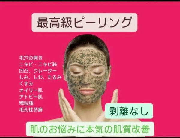【緊急美肌チャージ】最高級ハーブピーリング3回分 剥離なし