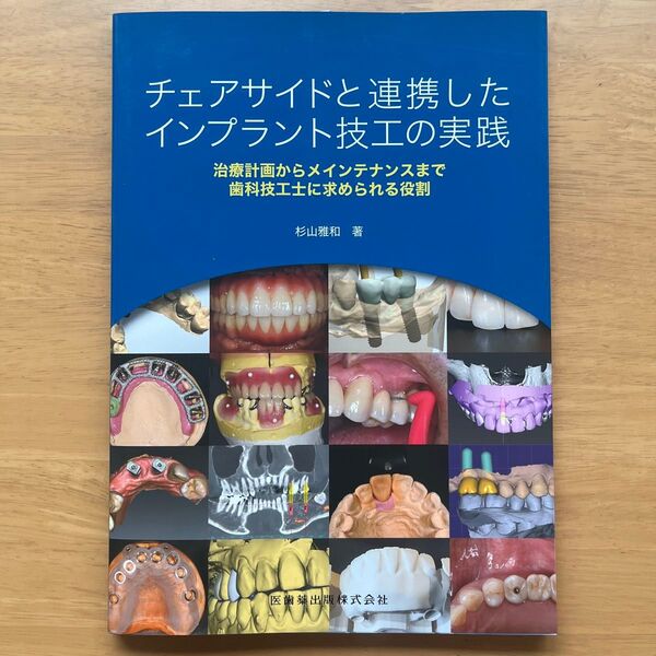 チェアサイドと連携したインプラント技工の実践 治療計画からメインテナンスまで歯科技工士に求められる役割 杉山雅和/著