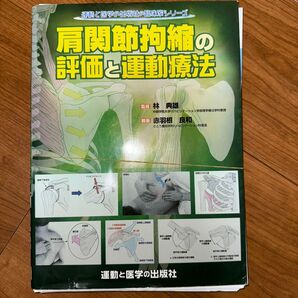 肩関節拘縮の評価と運動療法