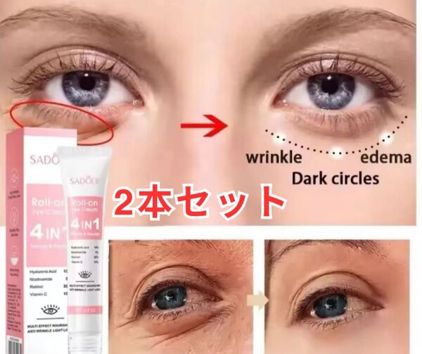 インスタントアイバッグ除去クリーム レチノール配合・シワ改善・ハリケア 4 in 1 ( 2本セット)