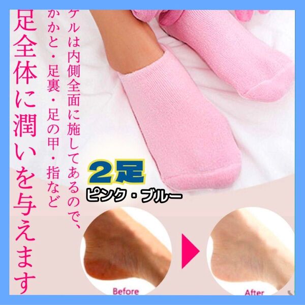靴下 ソックス サポーター 潤い 滑り止め 美容成分配合 ゲル付き靴下 ウルウル サラサラ ピンク ブルー