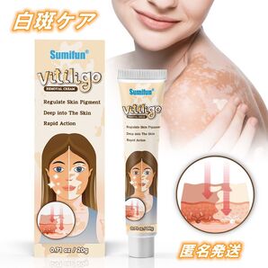 白斑ケアクリーム 天然ハーブエキス 白斑軟膏 20g 修復 ハーブ 色素沈着 肌色 修復 個別ケア用 1本 ボディケア コスメ