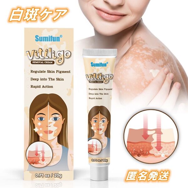白斑ケアクリーム 天然ハーブエキス 白斑軟膏 20g 修復 ハーブ 色素沈着 肌色 修復 個別ケア用 3本 ボディケア コスメ