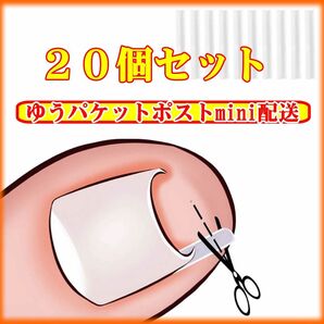 巻き爪保護チューブ 陥入爪や巻き爪の保護プレート 20本 巻き爪矯正