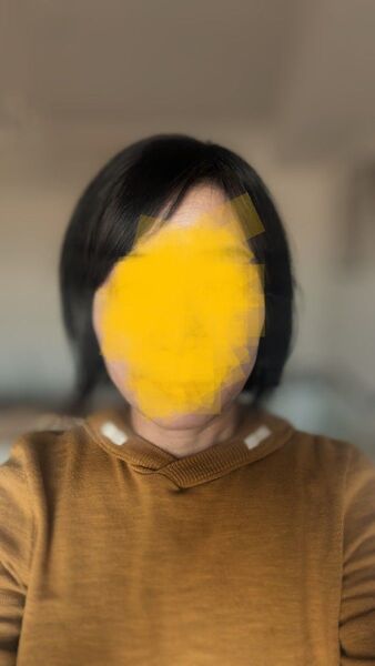 ナオアート シルクノーパート 部分ウィッグ 白髪かくし 薄毛 ナチュラルブラック