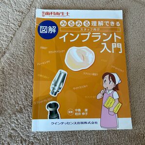 図解 みるみる理解できる スタッフ向け インプラント入門