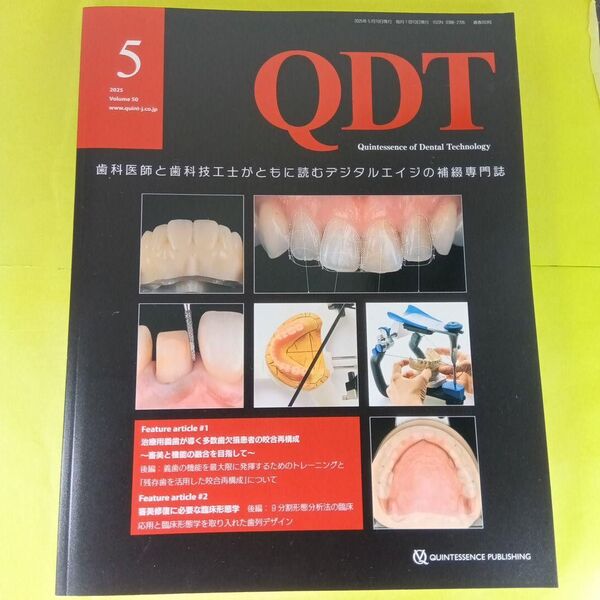 QDT 2025年5月号 治療用義歯が導く多数歯欠損患者の咬合再構成