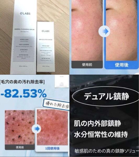 韓国 ブランド 鎮静セラム クレンジング セット 弱酸性 肌荒れ 鎮静 毛穴 黒ずみ 乾燥 保湿 ケア 敏感肌 人気 話題