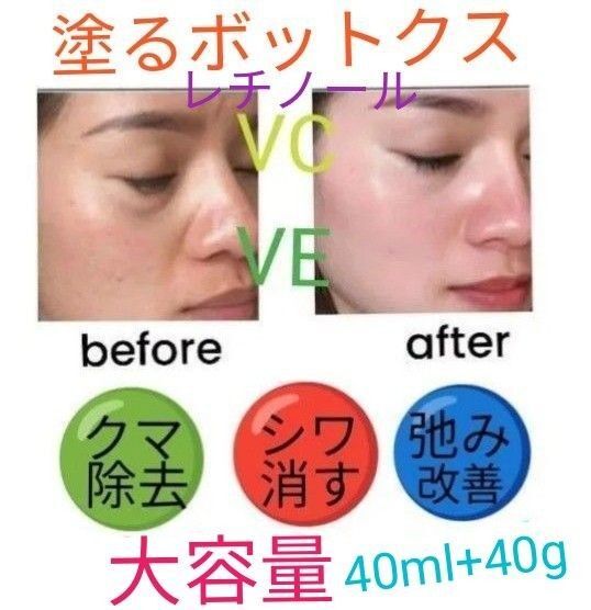 大容量塗るボトックス美容幹細胞&レチノール保湿ヒアルロン酸ターメリック ビタミンC コラーゲン lほうれい線マイクロニードル
