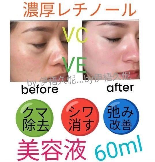 60mlレチノール&ビタミンCビタミンEヒアルロン酸美容液llほうれい線マイクロニードルダーマペンしわダーマスタンプ水光注射